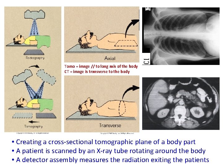Tomo = image // to long axis of the body CT = image is
