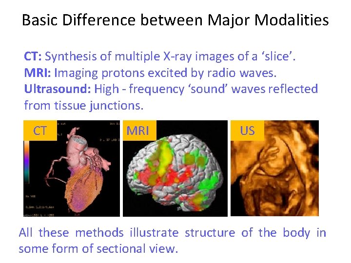 Basic Difference between Major Modalities CT: Synthesis of multiple X-ray images of a ‘slice’.
