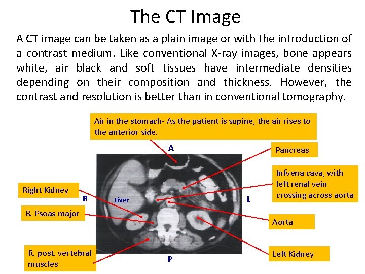 The CT Image A CT image can be taken as a plain image or