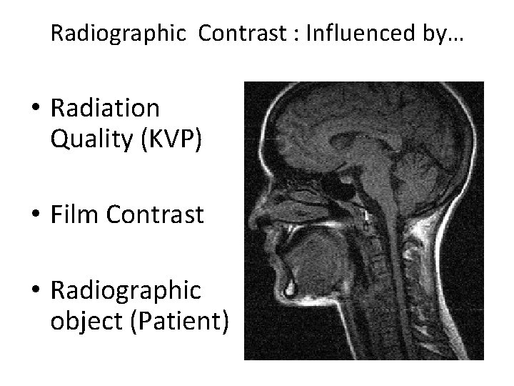 Radiographic Contrast : Influenced by… • Radiation Quality (KVP) • Film Contrast • Radiographic