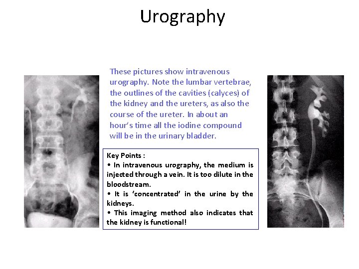Urography These pictures show intravenous urography. Note the lumbar vertebrae, the outlines of the