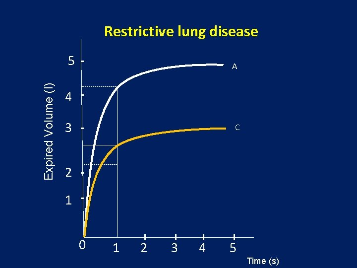 Restrictive lung disease Expired Volume (l) 5 A 4 3 C 2 1 0