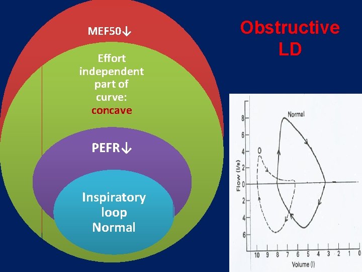 MEF 50↓ Effort independent part of curve: concave PEFR↓ Inspiratory loop Normal Obstructive LD