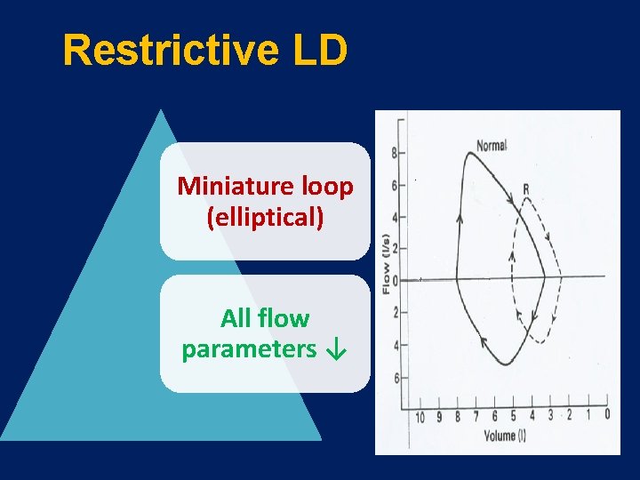 Restrictive LD Miniature loop (elliptical) All flow parameters ↓ 