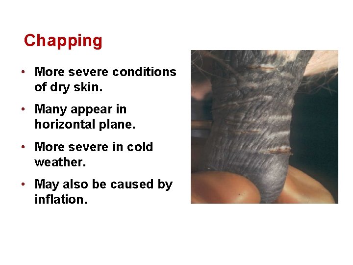 Chapping • More severe conditions of dry skin. • Many appear in horizontal plane.