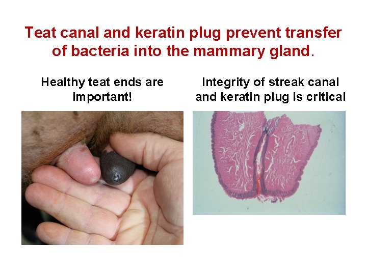 Teat canal and keratin plug prevent transfer of bacteria into the mammary gland. Healthy