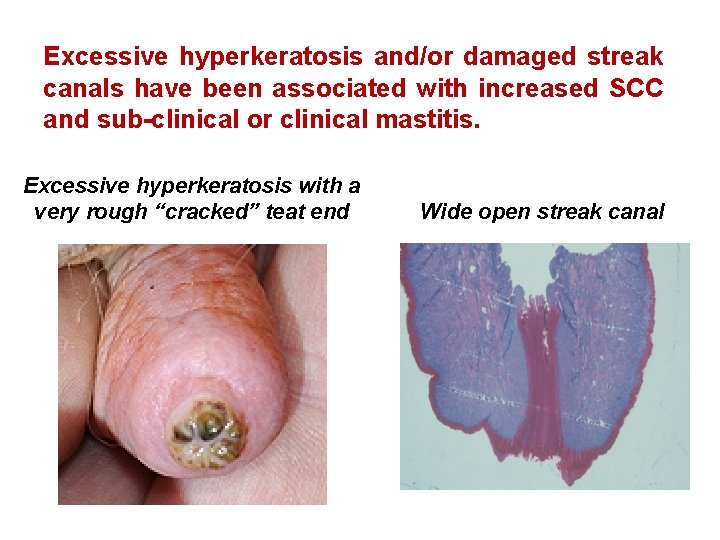 Excessive hyperkeratosis and/or damaged streak canals have been associated with increased SCC and sub-clinical