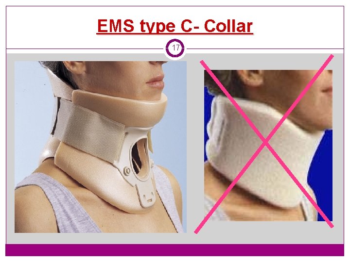 EMS type C- Collar 17 