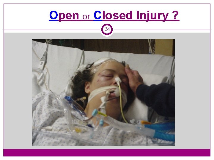 Open or Closed Injury ? 34 