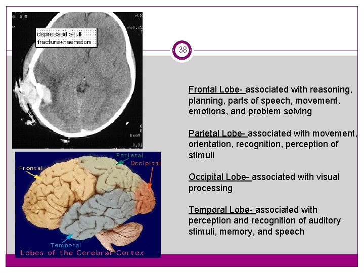 38 Frontal Lobe- associated with reasoning, planning, parts of speech, movement, emotions, and problem