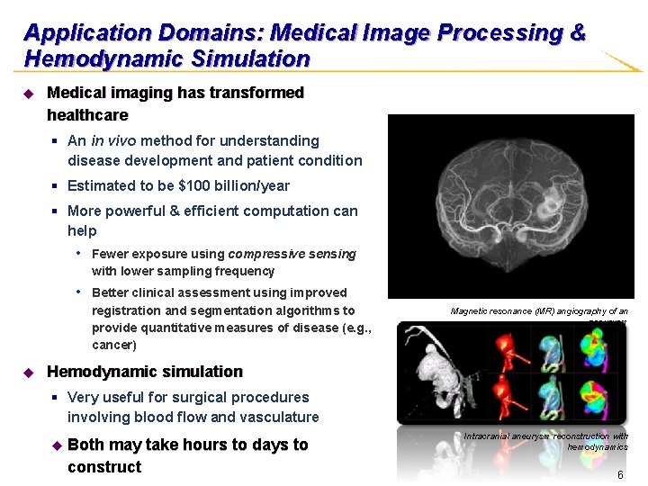 Application Domains: Medical Image Processing & Hemodynamic Simulation u Medical imaging has transformed healthcare