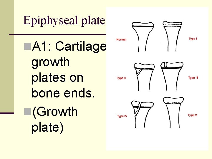 Epiphyseal plate n. A 1: Cartilage growth plates on bone ends. n(Growth plate) 