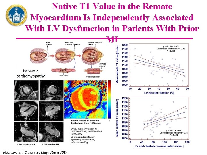 Native T 1 Value in the Remote Myocardium Is Independently Associated With LV Dysfunction