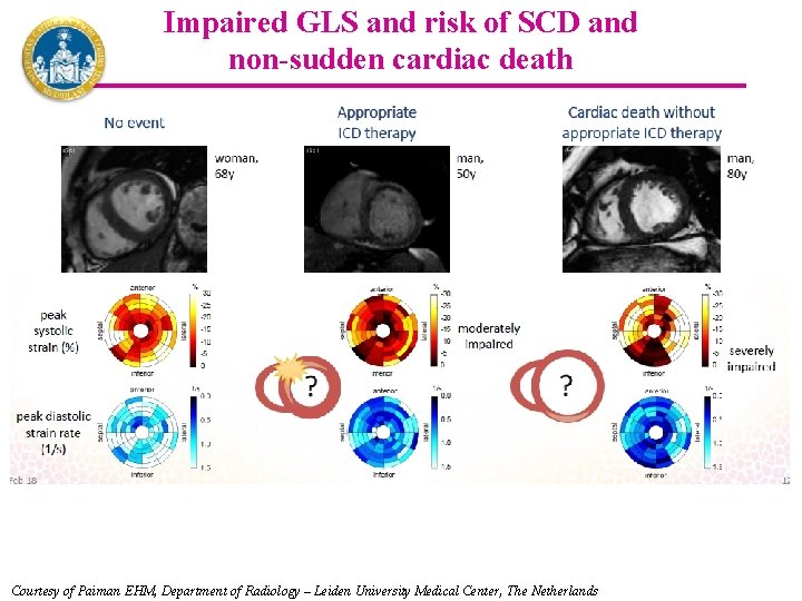 Impaired GLS and risk of SCD and non-sudden cardiac death Courtesy of Paiman EHM,