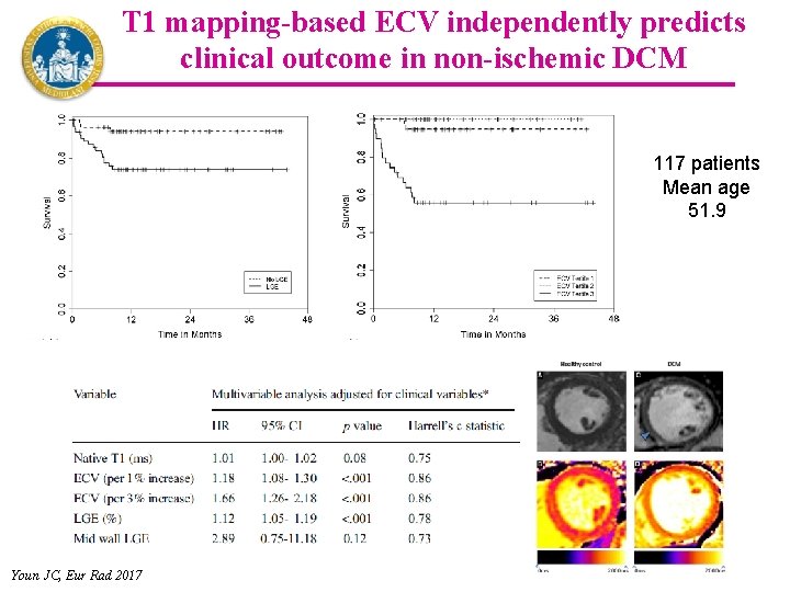 T 1 mapping-based ECV independently predicts clinical outcome in non-ischemic DCM 117 patients Mean
