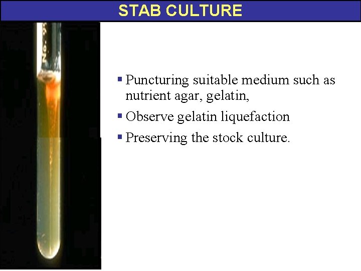 STAB CULTURE § Puncturing suitable medium such as nutrient agar, gelatin, § Observe gelatin STAB CULTURE § Puncturing suitable medium such as nutrient agar, gelatin, § Observe gelatin