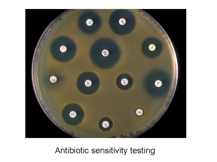 Antibiotic sensitivity testing 