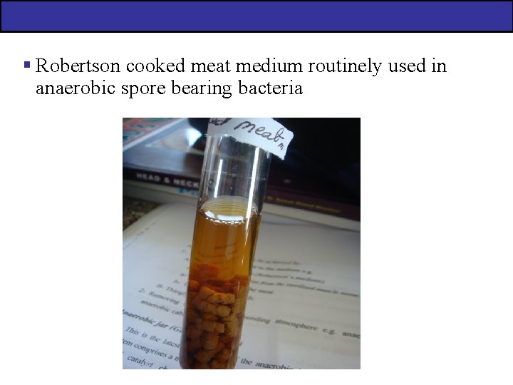 § Robertson cooked meat medium routinely used in anaerobic spore bearing bacteria 