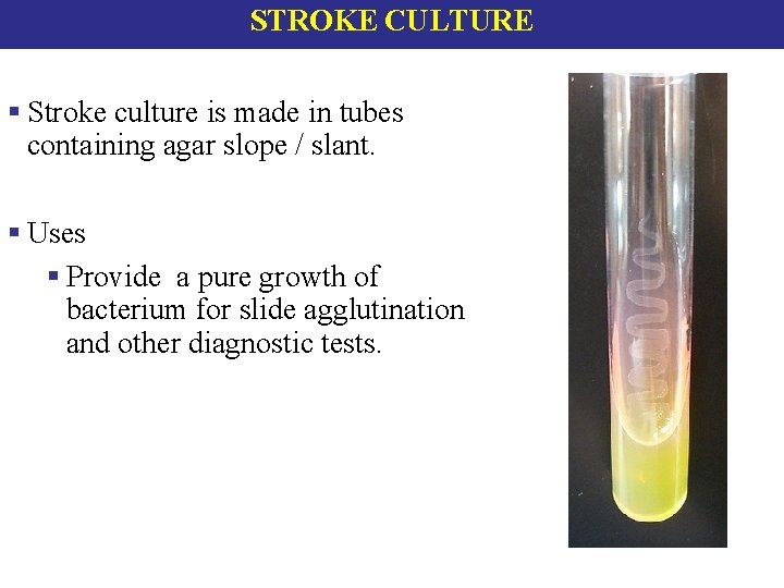 STROKE CULTURE § Stroke culture is made in tubes containing agar slope / slant. STROKE CULTURE § Stroke culture is made in tubes containing agar slope / slant.