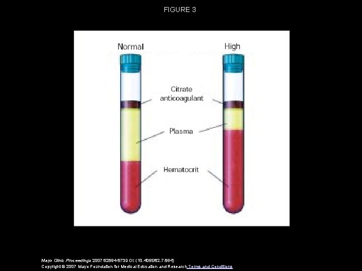 FIGURE 3 Mayo Clinic Proceedings 2007 82864 -873 DOI: (10. 4065/82. 7. 864) Copyright