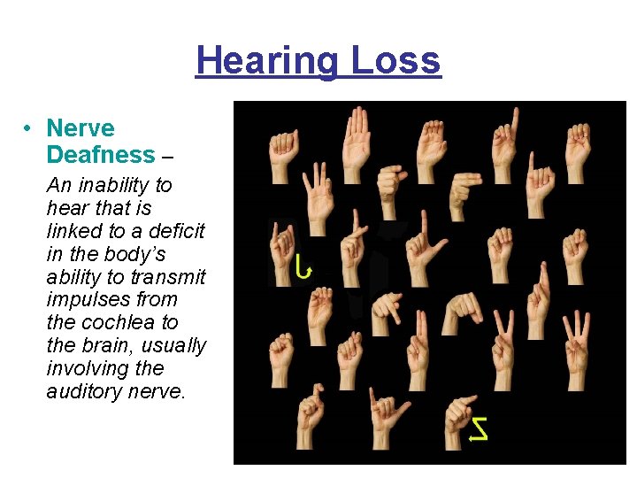 Hearing Loss • Nerve Deafness – An inability to hear that is linked to