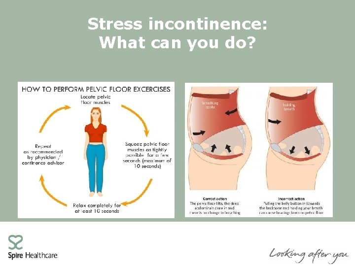 Stress incontinence: What can you do? 