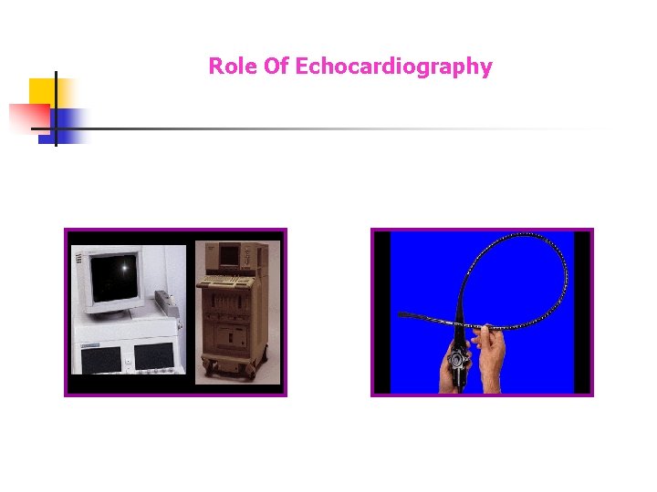 Role Of Echocardiography Role Of Echocardiography
