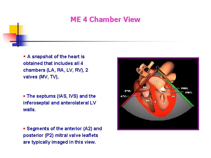 ME 4 Chamber View § A snapshot of the heart is obtained that includes ME 4 Chamber View § A snapshot of the heart is obtained that includes