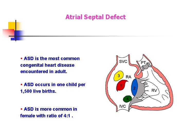 Atrial Septal Defect § ASD is the most common congenital heart disease encountered in Atrial Septal Defect § ASD is the most common congenital heart disease encountered in