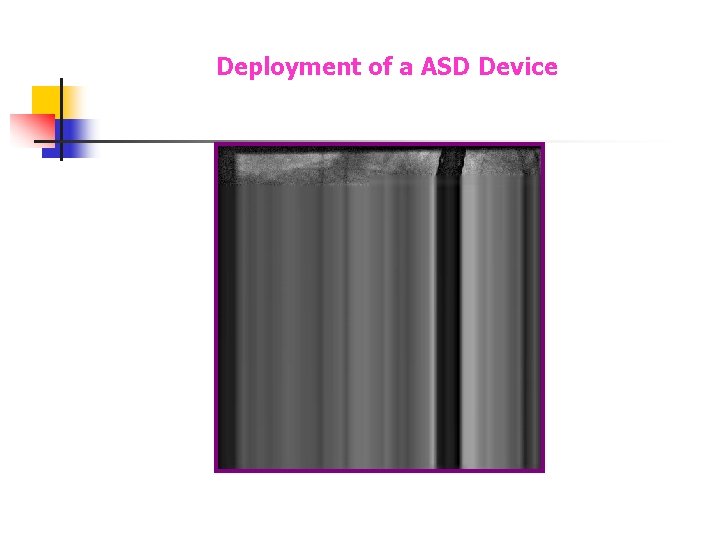 Deployment of a ASD Device Deployment of a ASD Device