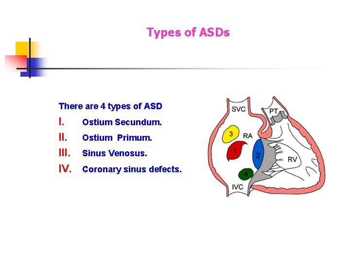 Types of ASDs There are 4 types of ASD I. III. IV. Ostium Secundum. Types of ASDs There are 4 types of ASD I. III. IV. Ostium Secundum.