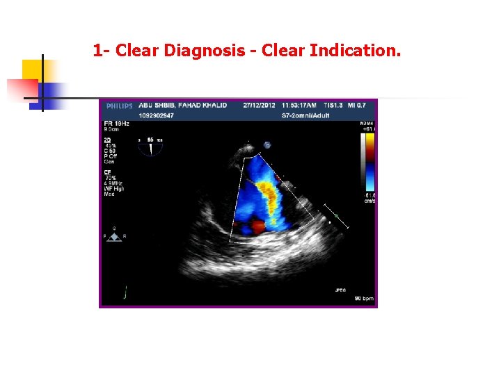 1 - Clear Diagnosis - Clear Indication. 1 - Clear Diagnosis - Clear Indication.