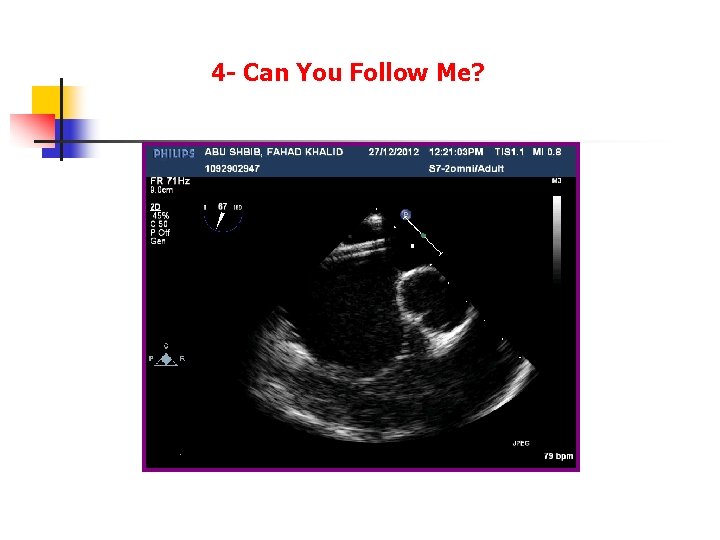 4 - Can You Follow Me? 4 - Can You Follow Me?