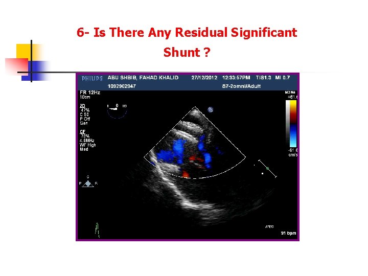 6 - Is There Any Residual Significant Shunt ? 6 - Is There Any Residual Significant Shunt ?