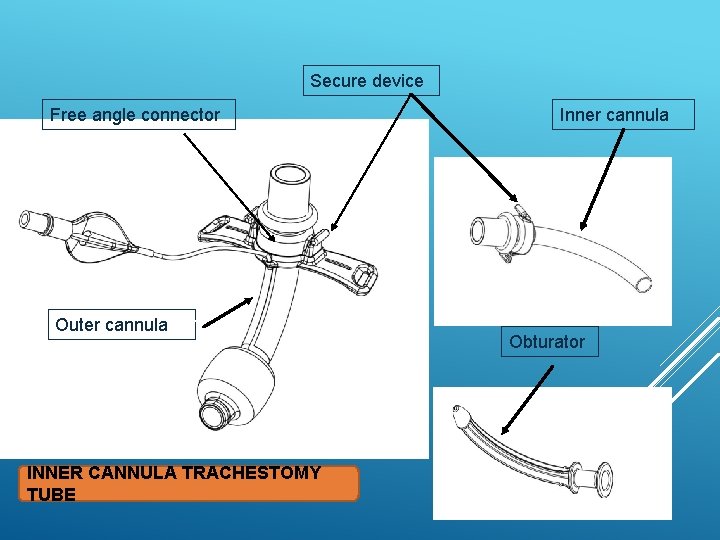 Secure device Free angle connector Outer cannula INNER CANNULA TRACHESTOMY TUBE Inner cannula Obturator
