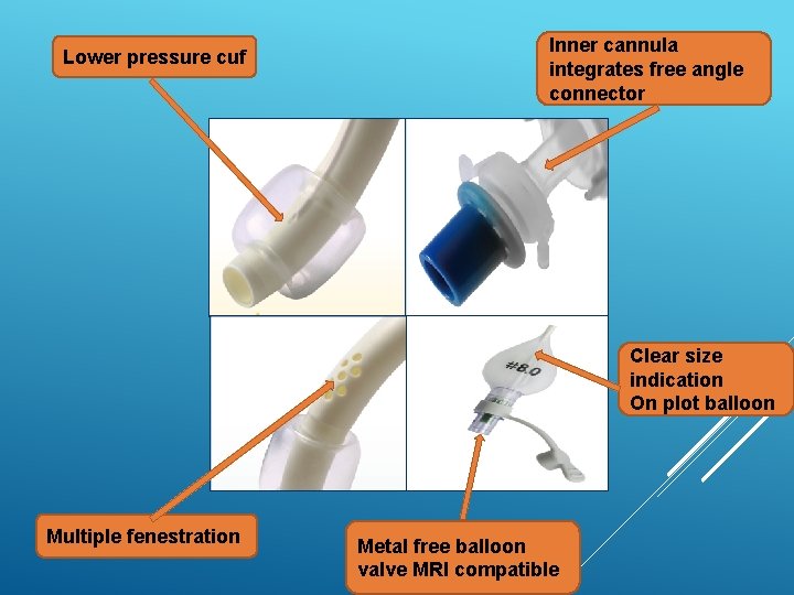 Lower pressure cuf Inner cannula integrates free angle connector Clear size indication On plot