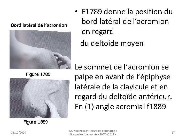 Bord latéral de l’acromion Figure 1789 • F 1789 donne la position du bord