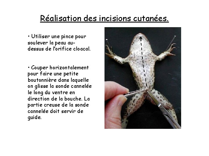 Réalisation des incisions cutanées. • Utiliser une pince pour soulever la peau audessus de Réalisation des incisions cutanées. • Utiliser une pince pour soulever la peau audessus de