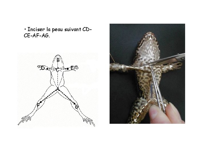 • Inciser la peau suivant CDCE-AF-AG. B D C E A F G • Inciser la peau suivant CDCE-AF-AG. B D C E A F G