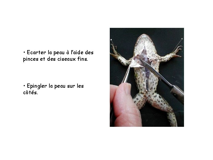 • Ecarter la peau à l’aide des pinces et des ciseaux fins. • • Ecarter la peau à l’aide des pinces et des ciseaux fins. •