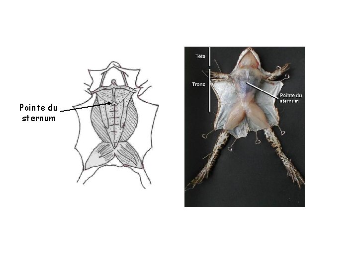 Pointe du sternum 