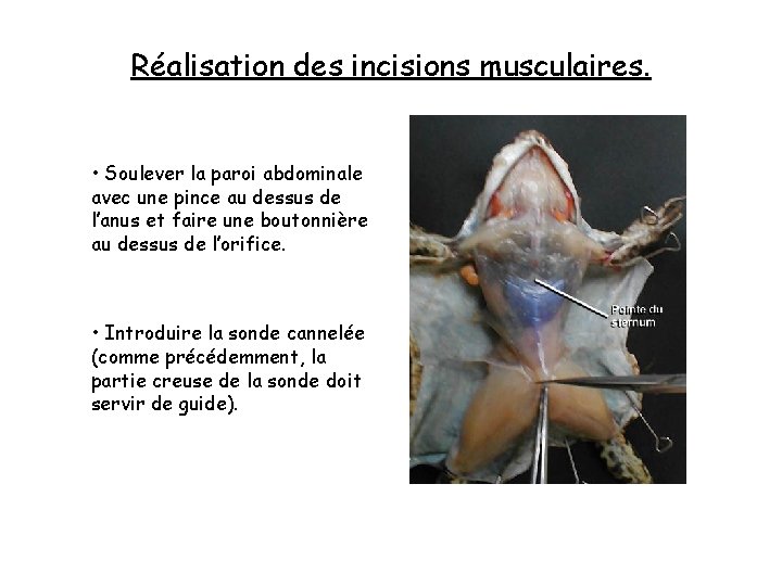 Réalisation des incisions musculaires. • Soulever la paroi abdominale avec une pince au dessus