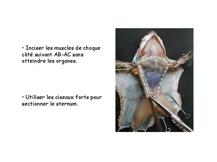 • Inciser les muscles de chaque côté suivant AB-AC sans atteindre les organes. • Inciser les muscles de chaque côté suivant AB-AC sans atteindre les organes.