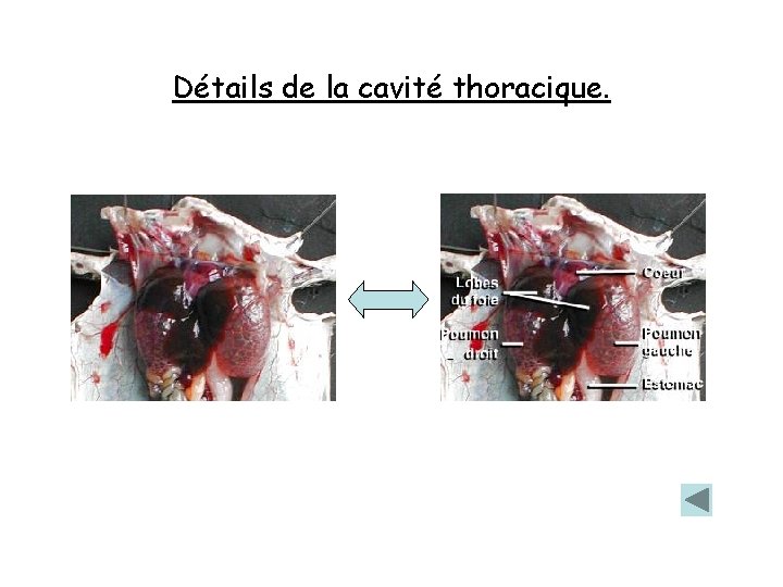 Détails de la cavité thoracique. 