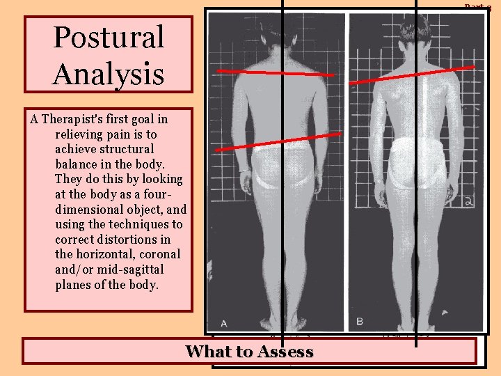 Part-3 Postural Analysis A Therapist's first goal in relieving pain is to achieve structural