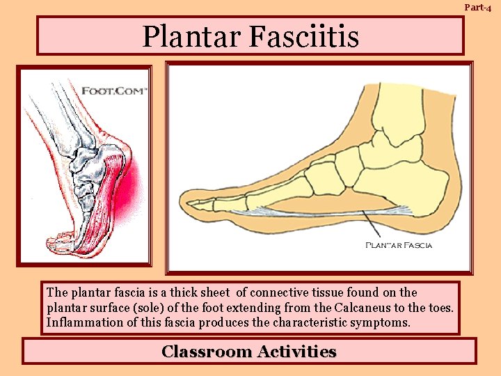 Part-4 Plantar Fasciitis The plantar fascia is a thick sheet of connective tissue found