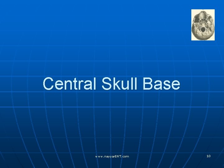 Central Skull Base www. nayyar. ENT. com 10 