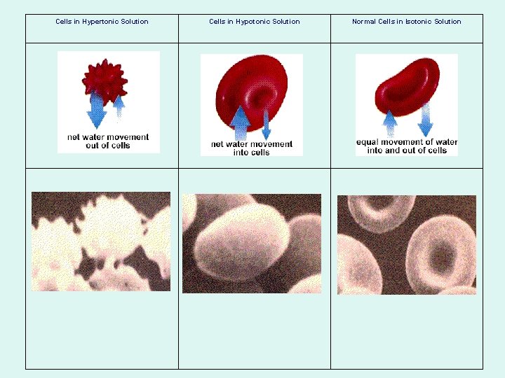 Cells in Hypertonic Solution Cells in Hypotonic Solution Normal Cells in Isotonic Solution 