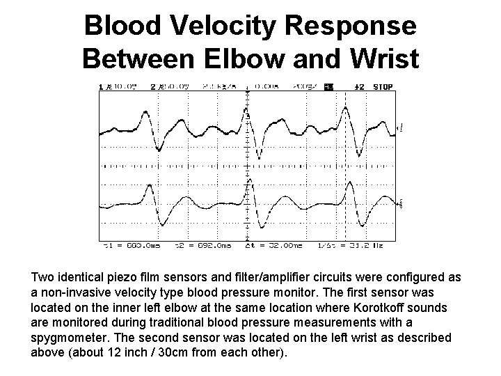 Blood Velocity Response Between Elbow and Wrist Two identical piezo film sensors and filter/amplifier