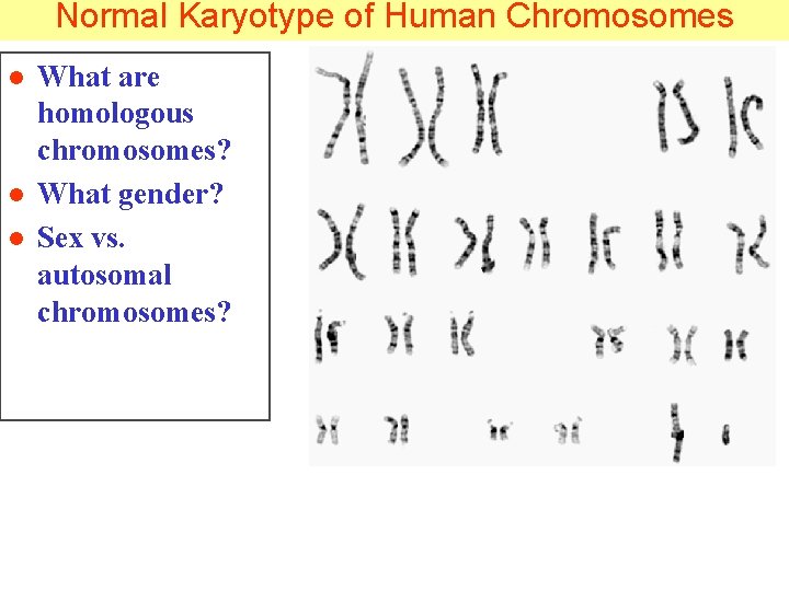 Normal Karyotype of Human Chromosomes l l l What are homologous chromosomes? What gender?